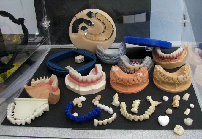 Зубные протезы, созданные с помощью технологии трехмерной печати